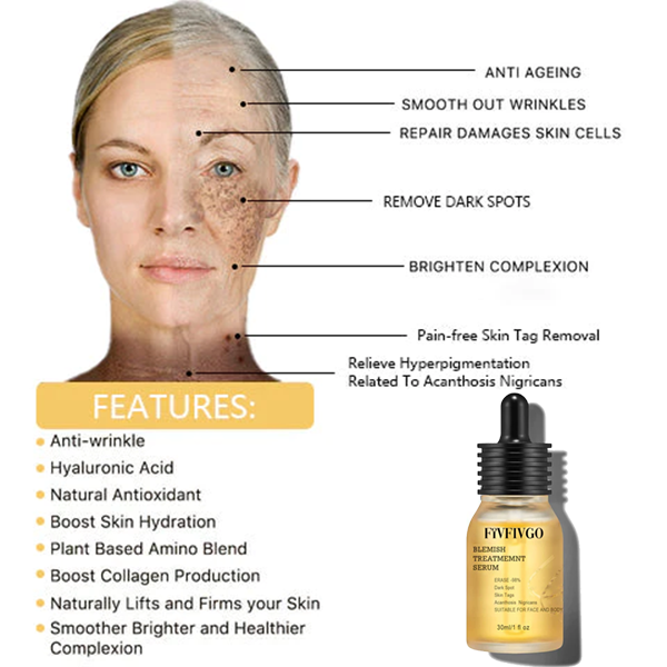 Fivfivgo™ Blemish Treatment serum for Dark Spots & Acanthosis Nigricans & Skin Tag