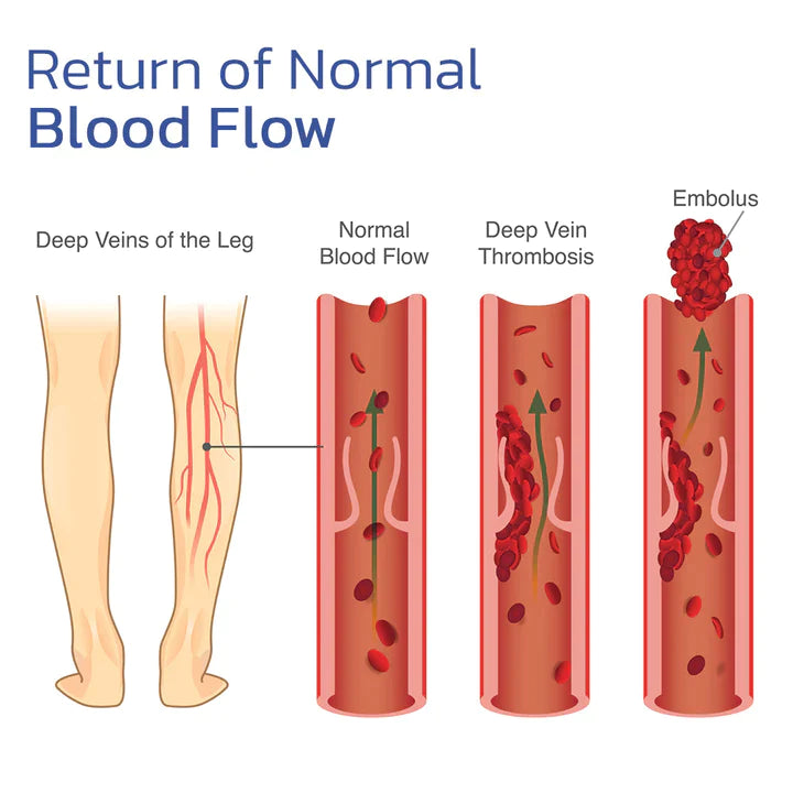 ReduceFast™ Mugwort Acupressure Detoxing&Shaping Knee Pads
