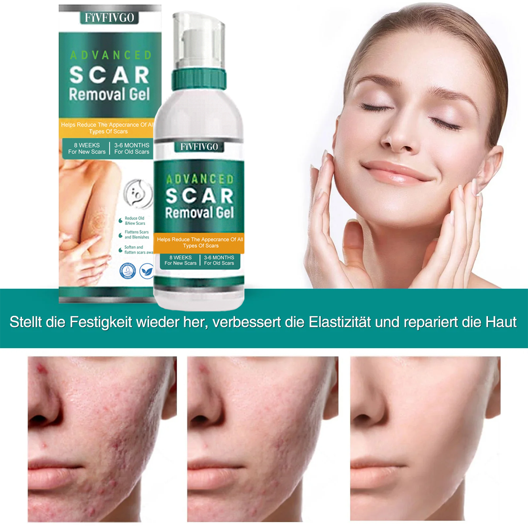 Fivfivgo™ ScarRemove Advanced Narbenspray