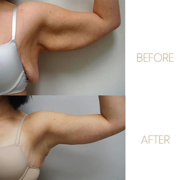 JANSIO Lymphatic Drainage Body Detox Ring