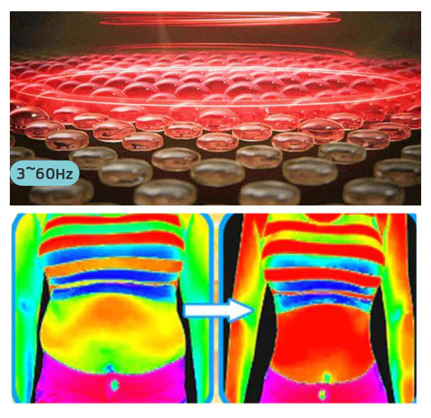 Slimwe Ultrasonic Body Shape Wristband