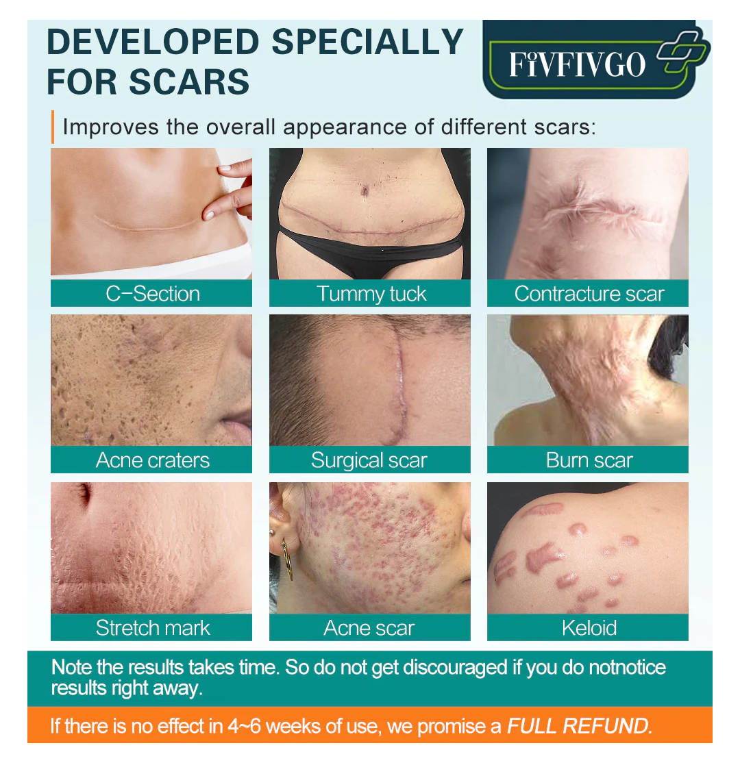 Fivfivgo™ Advanced Scar Removal Spray
