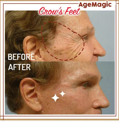 YoungerMi Seaweed Collagen Tightening Eye Mask Patch