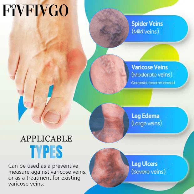 Fivfivgo™ Anti-Bunions & Varicose Veins Health Sock