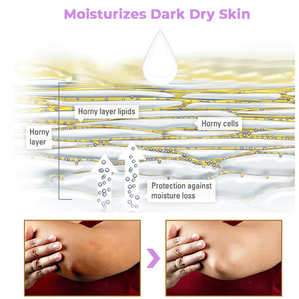 Fivfivgo™ Collagen Acanthosis Nigricans Therapiecreme