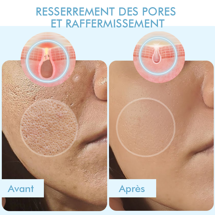 Oveallgo™ Masque Coréen Bio-Collagène Profond Réel