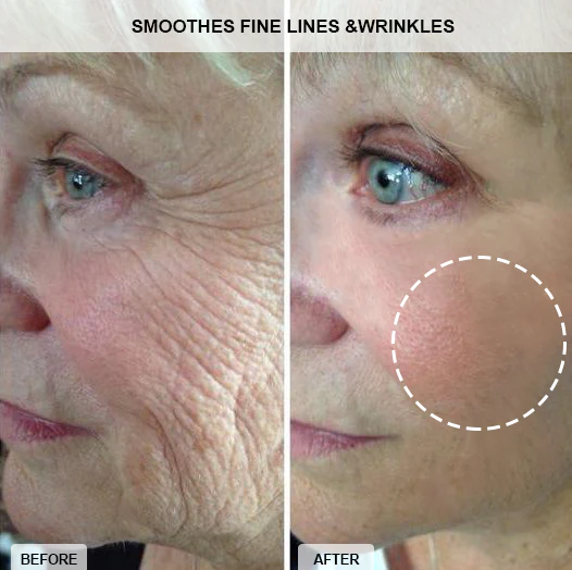 Fivfivgo™ Collagen-Boost Lift Anti-Aging Creme