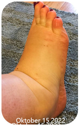 Fivfivgo™ Anti Knöchelödem Socken
