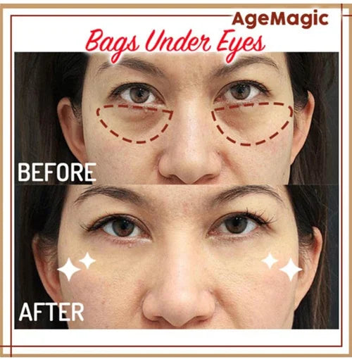 YoungerMi Seaweed Collagen Tightening Eye Mask Patch