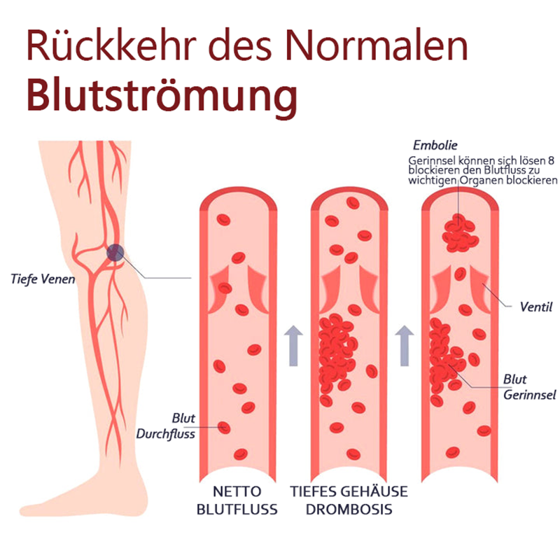 Fivfivgo™ VeinHealing Varizen Behandlungsspray