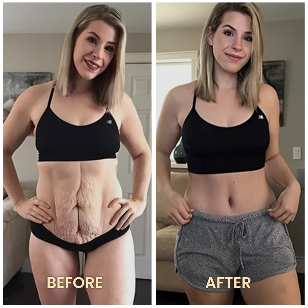 Fivfivgo™ IonFiber Far Infrared Restoration Shaper Bodysuit
