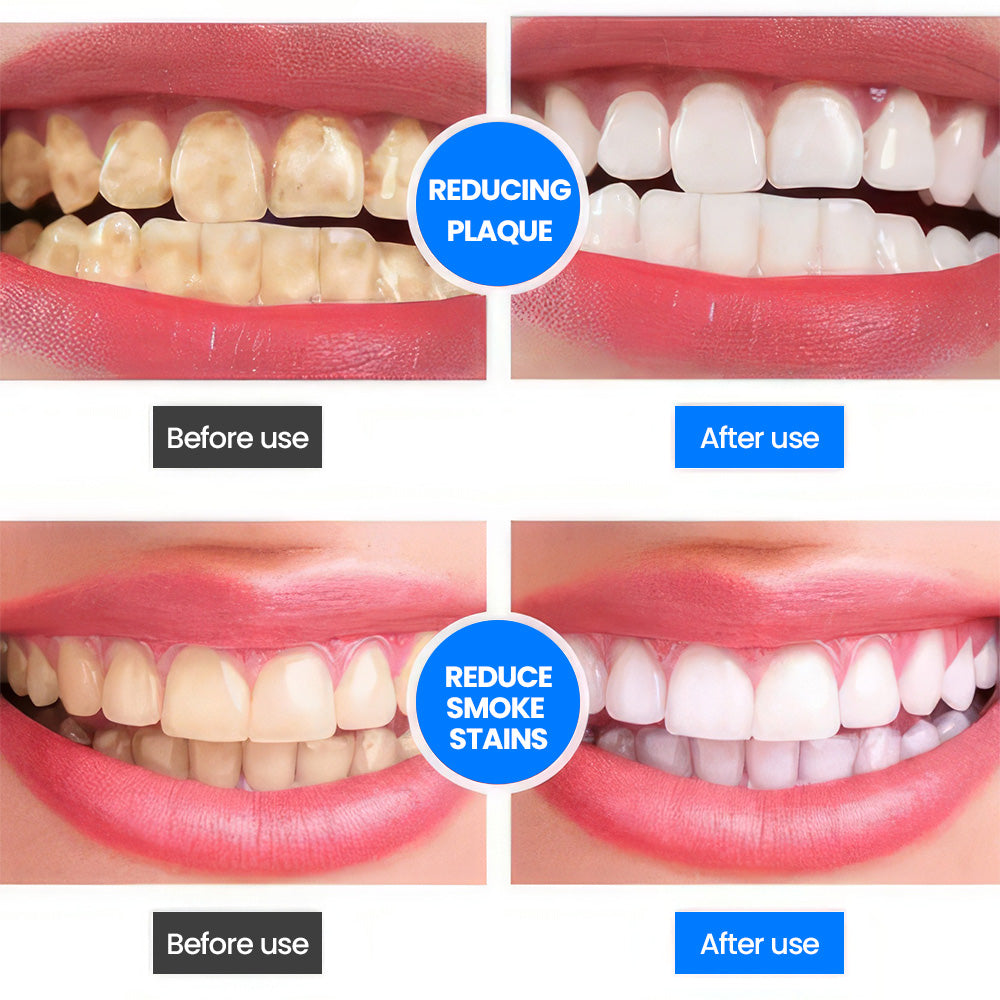 Fivfivgo™ SP-4 Probiotic Whitening Toothpaste