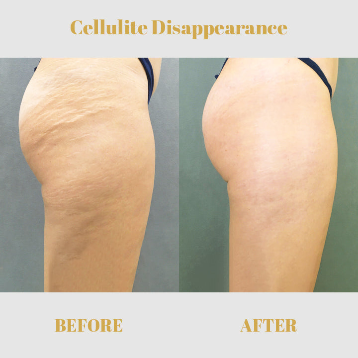 Fivfivgo™ Collagen Buttock Enlargement Patch