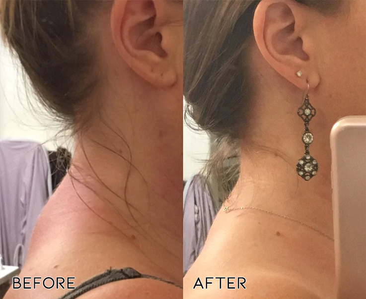 WholeBody EMS Gerät zur Muskelschmerzlinderung