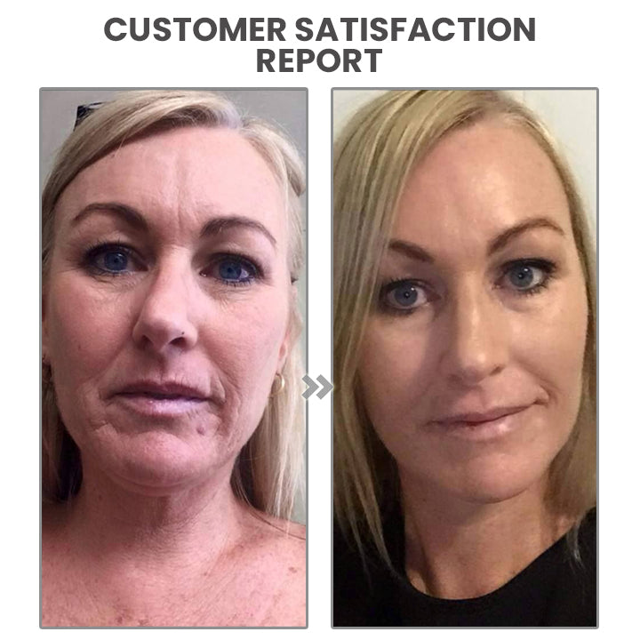 ChaffeeLife™ Faltenumkehrendes Botox-Serum