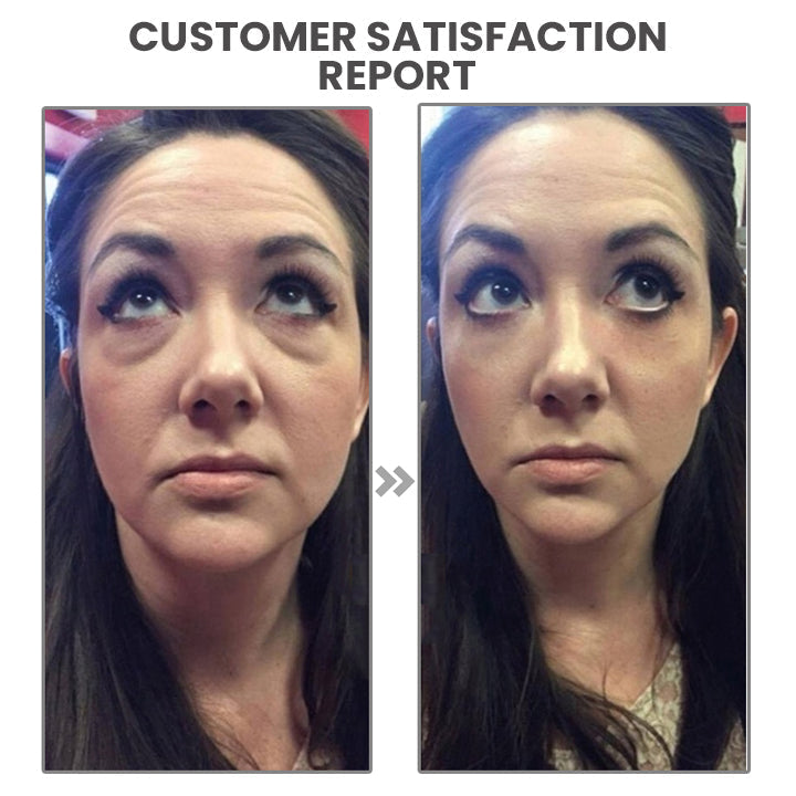 ChaffeeLife™ Faltenumkehrendes Botox-Serum