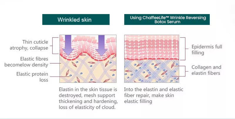 ChaffeeLife™ Faltenumkehrendes Botox-Serum
