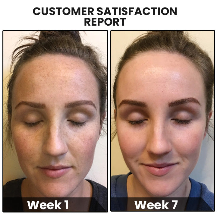 CollagenPro™ Japanese Anti-Aging Löslicher Kollagen Seide Ball