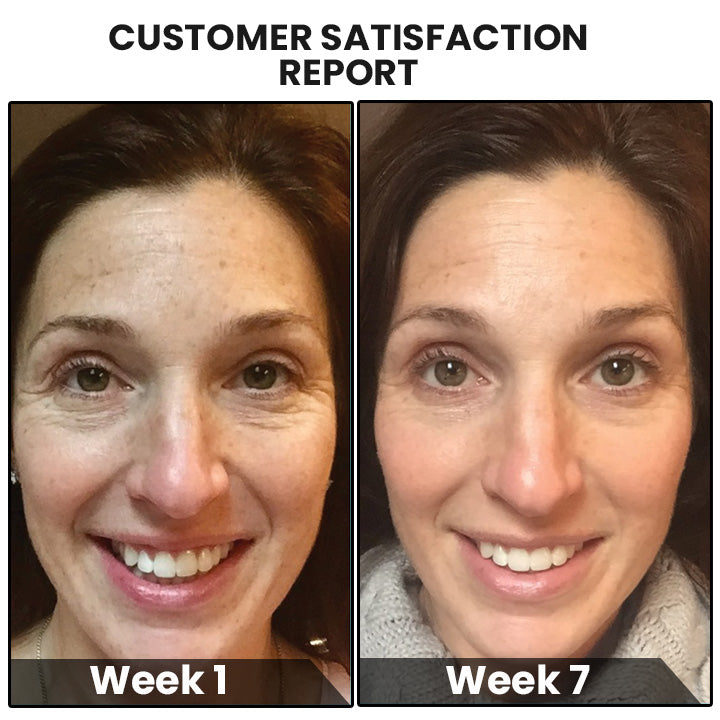 CollagenPro™ Japanese Anti-Aging Löslicher Kollagen Seide Ball