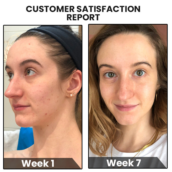 CollagenPro™ Japanese Anti-Aging Löslicher Kollagen Seide Ball