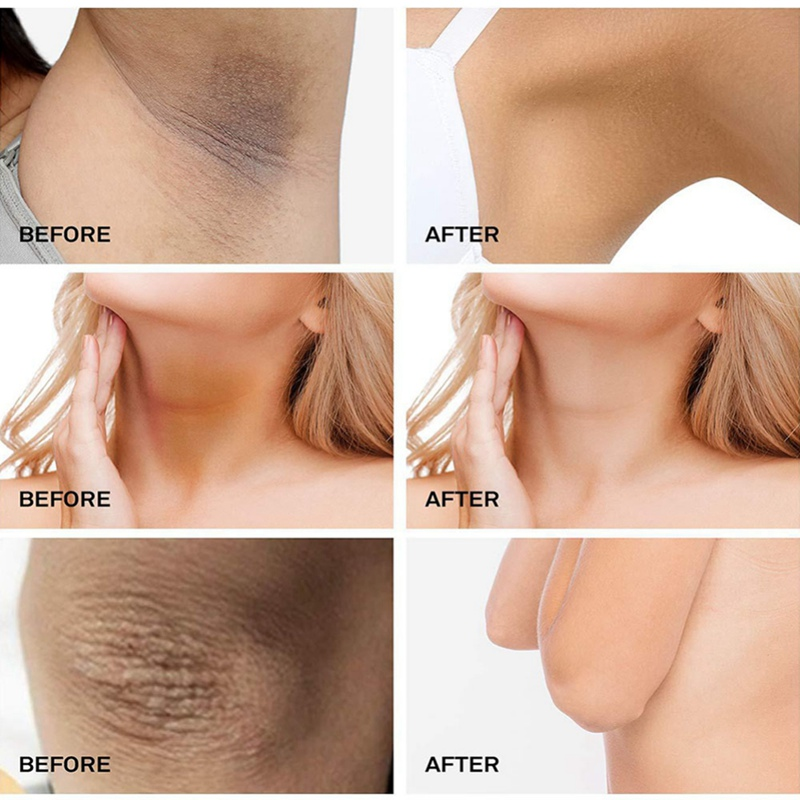 Fivfivgo™ Depigmenting and Toxin-removing Body Soap