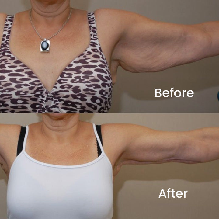 EMS Lymphdrainage-Massagekissen