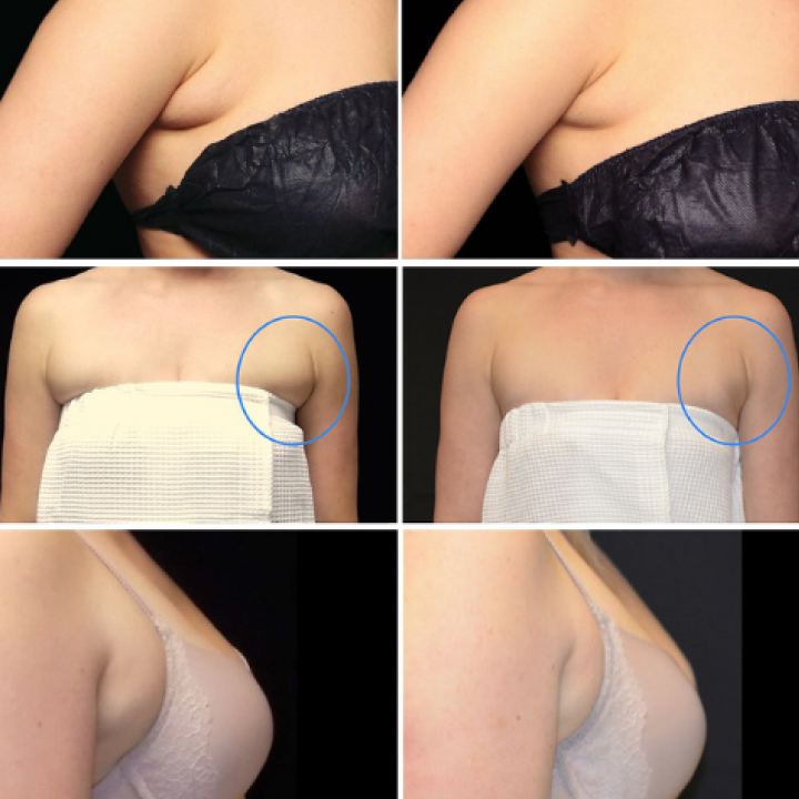 LypmhDrainPRO Lymphe Entgiftung Ingweröl