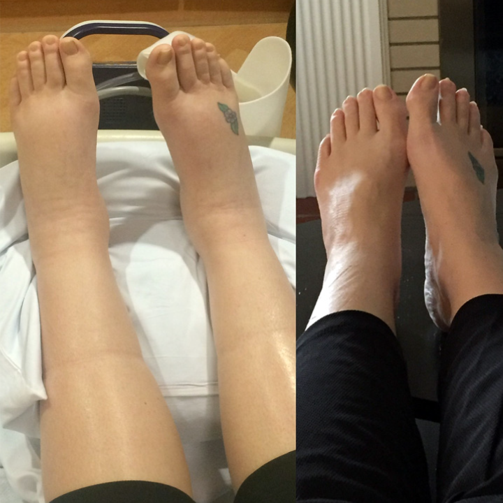 LypmhDrainPRO Lymphe Entgiftung Ingweröl