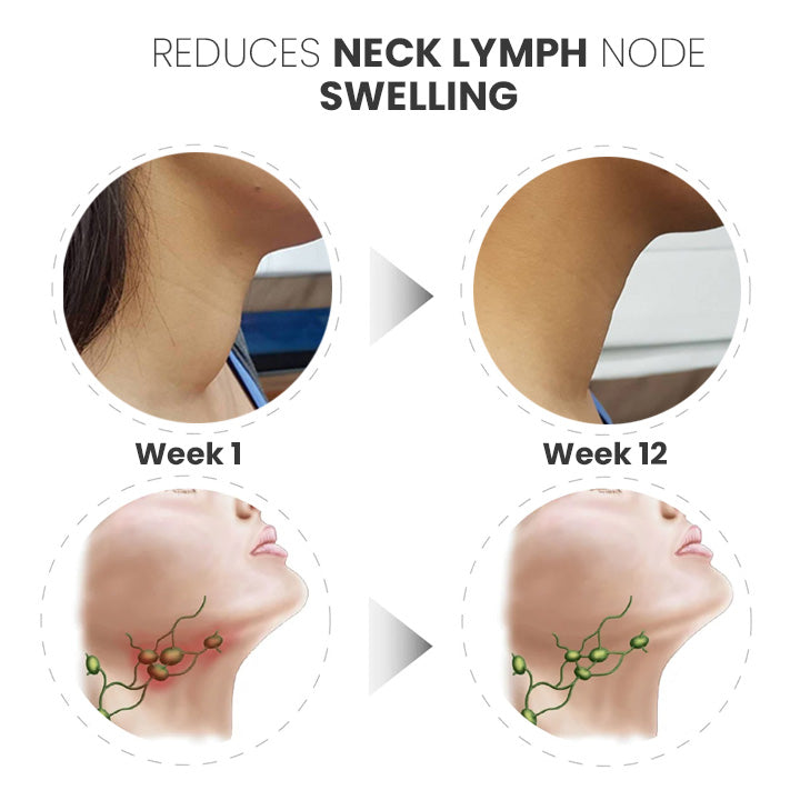 GooLiving AntiHump Lymphcare Ingwer-Salbe