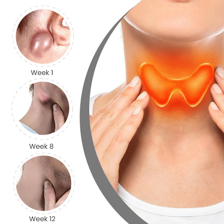 GooLiving AntiHump Lymphcare Ingwer-Salbe