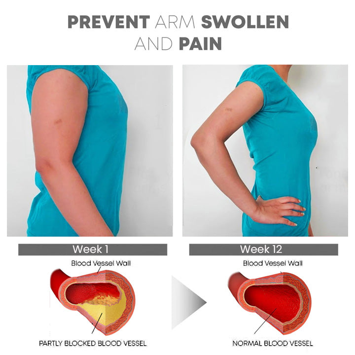 GooLiving AntiHump Lymphcare Ingwer-Salbe