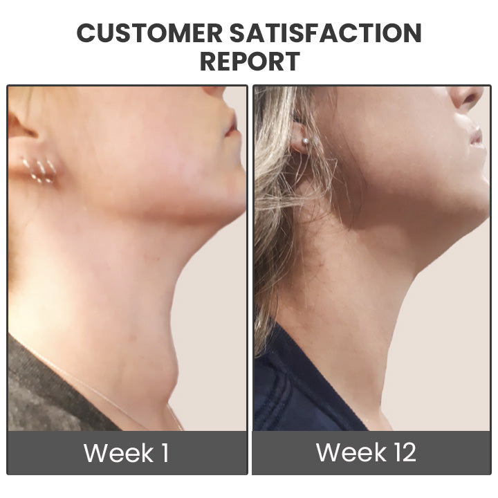 GooLiving AntiHump Lymphcare Ingwer-Salbe