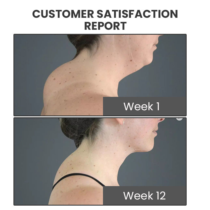 GooLiving AntiHump Lymphcare Ingwer-Salbe