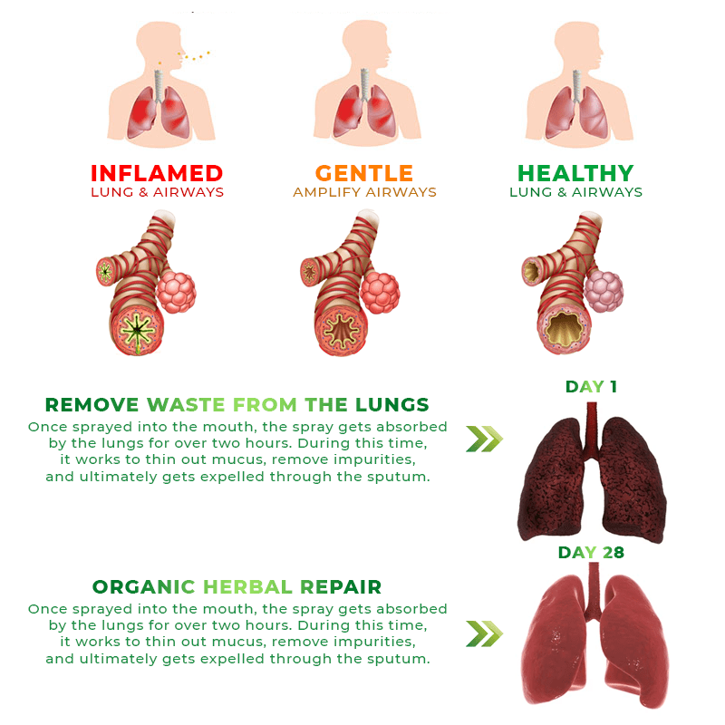 Fivfivgo™ RespiAid Herbal Lung Cleansing Spray