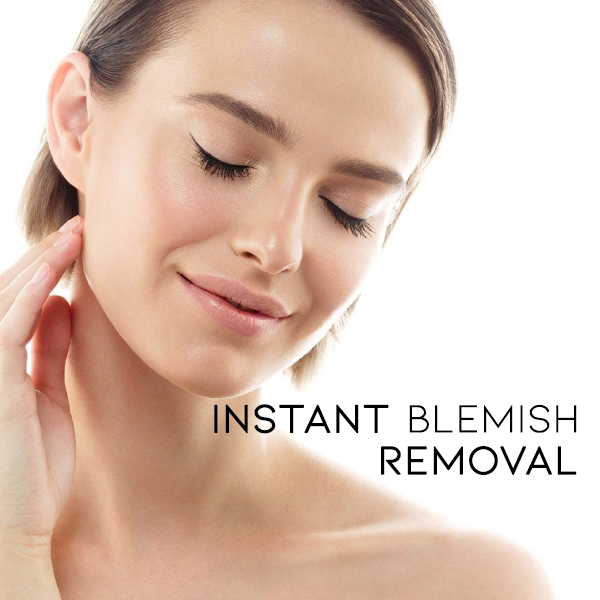 Bvanish™ Dark Spot Removal Cream