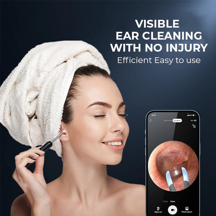 Fivfivgo™ EarWax Clean Pro Otoscope with Wi-Fi Visible Wax Removal Spoon