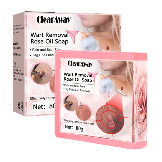 ClearAway Seife zur Entfernung von Warzen mit Rosenöl