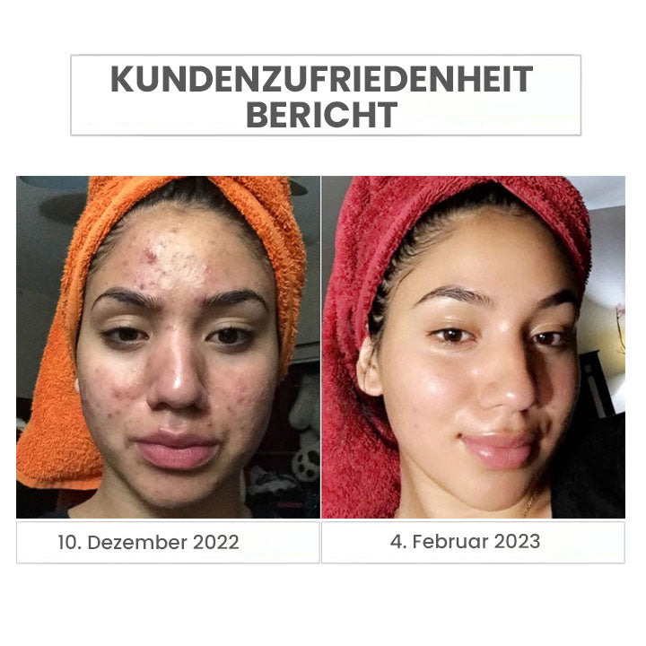Fivfivgo™ Japan Natürlicher Aminosäuren-Reinigungsschaum