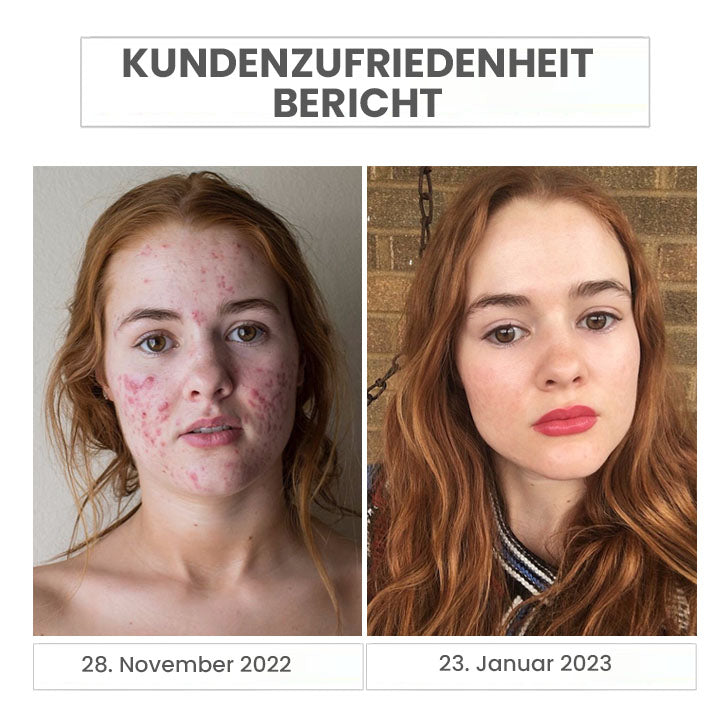 Fivfivgo™ Japan Natürlicher Aminosäuren-Reinigungsschaum