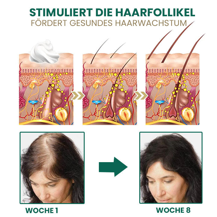 Fivfivgo™ Glamor Ginger EssentialHaarwuchscreme