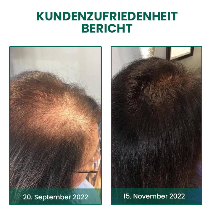 Fivfivgo™ Glamor Ginger EssentialHaarwuchscreme