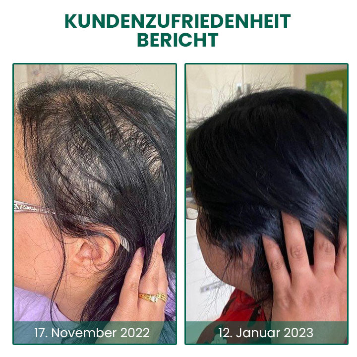 Fivfivgo™ Glamor Ginger EssentialHaarwuchscreme