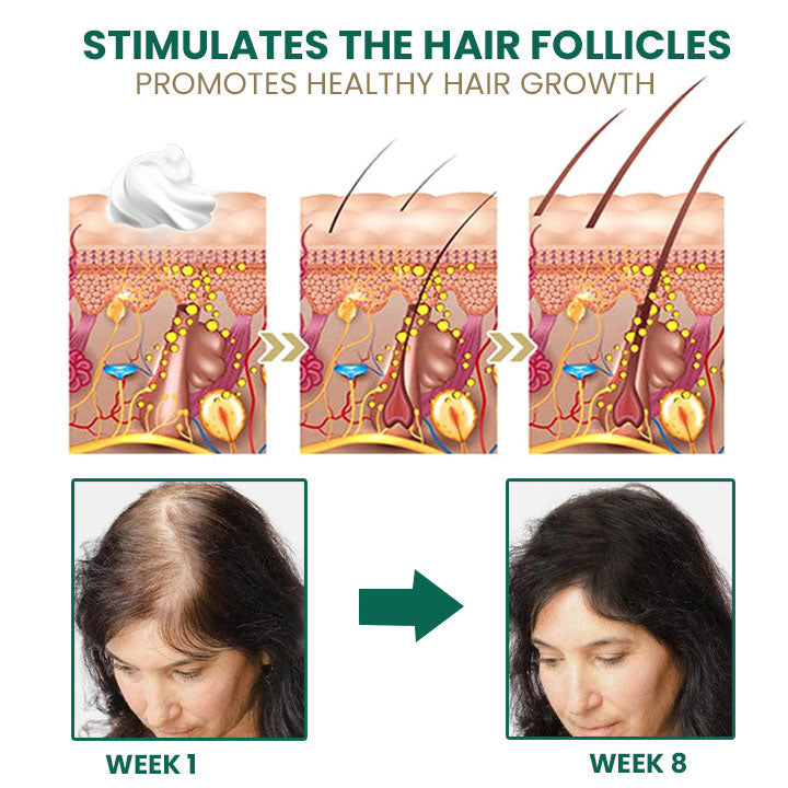 Fivfivgo™ Glamor Ginger Essential Hair Growth Cream