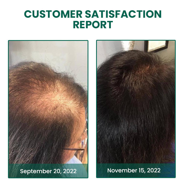 Fivfivgo™ Glamor Ginger Essential Hair Growth Cream