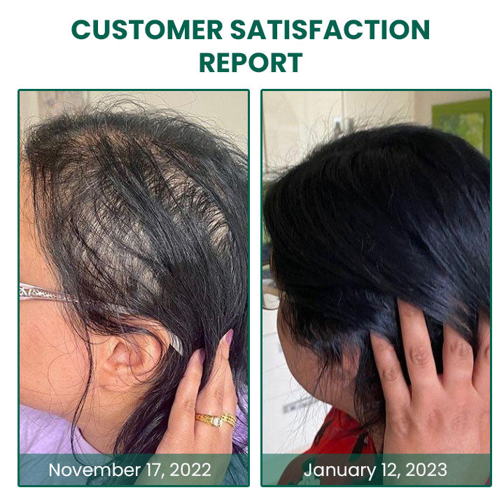 Fivfivgo™ Glamor Ginger Essential Hair Growth Cream