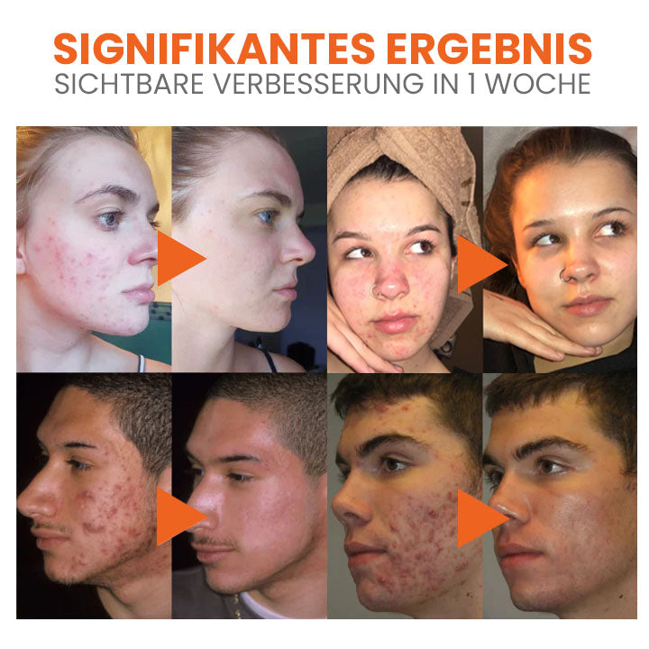 Fivfivgo™ Karotte Porenreinigende Blasenmaske