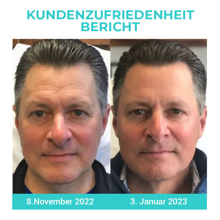 Fivfivgo™ Korea TimerAlter Männer Ölkontrolle Tone Up Creme