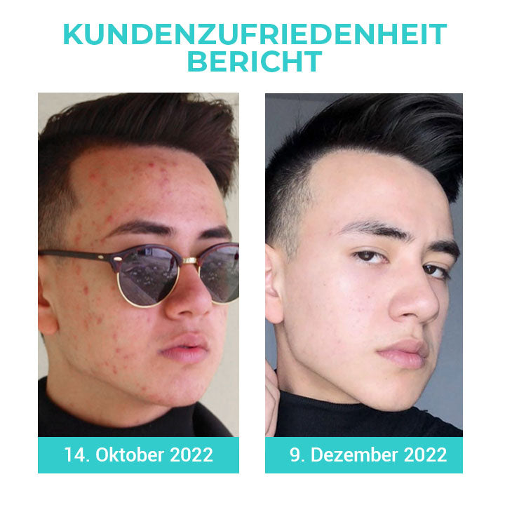 Fivfivgo™ Korea TimerAlter Männer Ölkontrolle Tone Up Creme