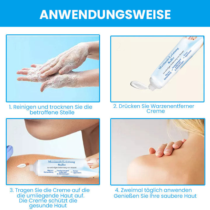 Fivfivgo™ MaximaleLeistung Salbe zur sofortigen Entfernung von Warzen