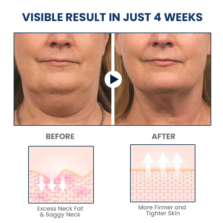 Fivfivgo™ JawFit Pro Face Sculptor